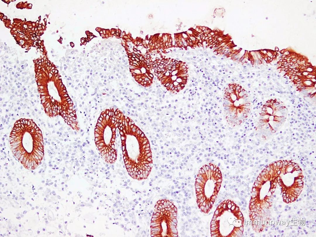 免疫组化（IHC）│常见问题及解析集锦