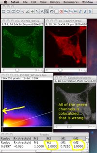 ImageJ实用技巧——荧光共定位分析(定量分析篇)