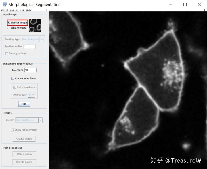 ImageJ实用教程——细胞膜荧光强度检测(定量分析篇)