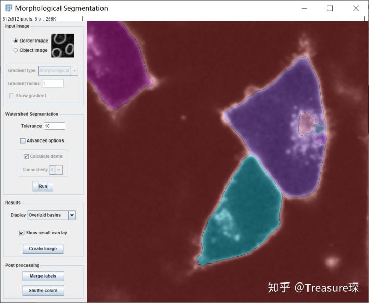 ImageJ实用教程——细胞膜荧光强度检测(定量分析篇)