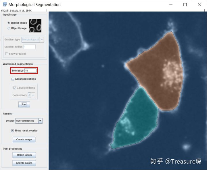 ImageJ实用教程——细胞膜荧光强度检测(定量分析篇)