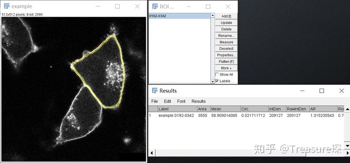 ImageJ实用教程——细胞膜荧光强度检测(定量分析篇)