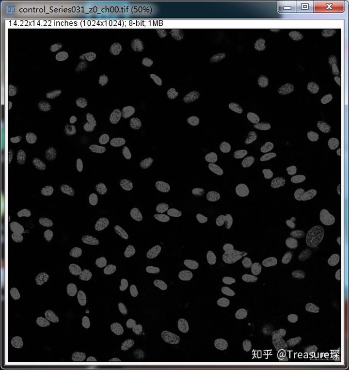 ImageJ实用技巧——自动细胞计数(解放双手篇)