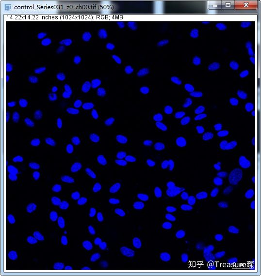 ImageJ实用技巧——自动细胞计数(解放双手篇)
