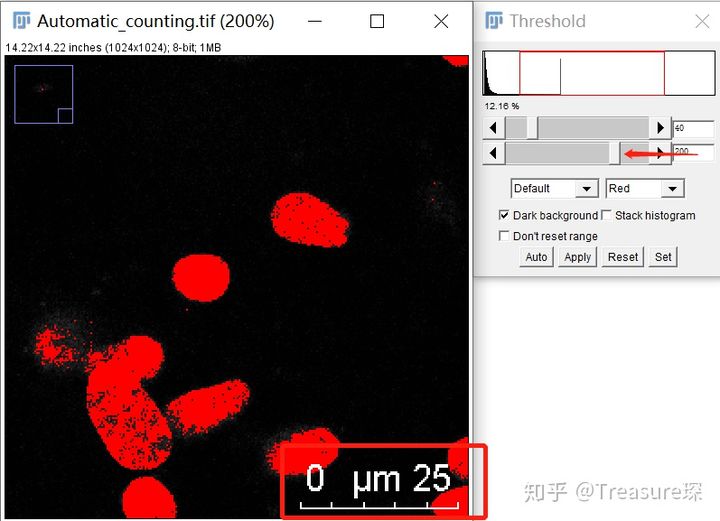 ImageJ实用技巧——自动细胞计数(解放双手篇)