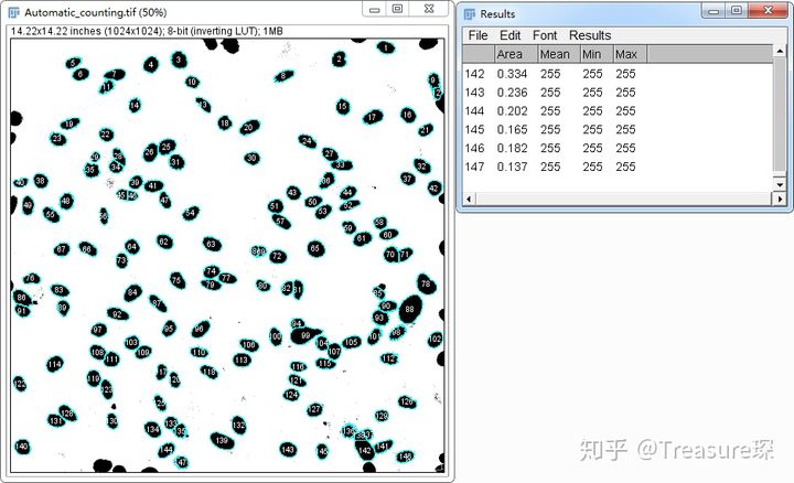 ImageJ实用技巧——自动细胞计数(解放双手篇)