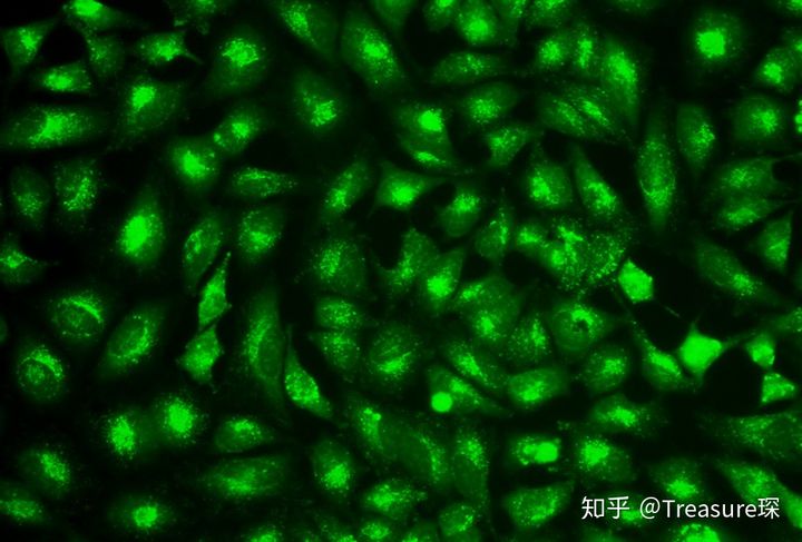 ImageJ实用技巧——不规则细胞分割&计数(解放双手篇)