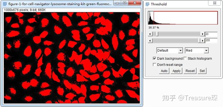 ImageJ实用技巧——不规则细胞分割&计数(解放双手篇)